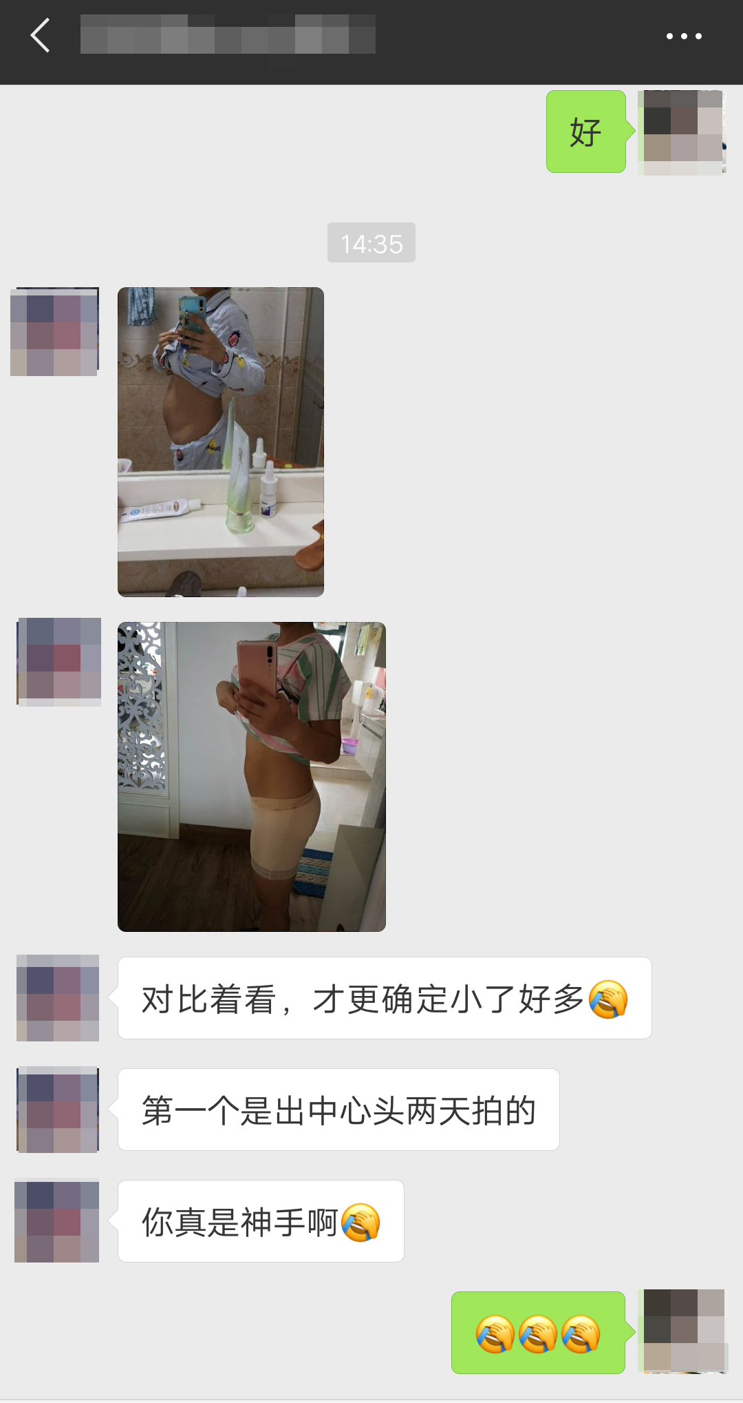 做了3次腹直肌修复的反馈.jpg